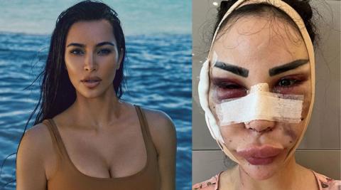 Jennifer Pamplona Spent Millions To Look Like Kim Kardashian