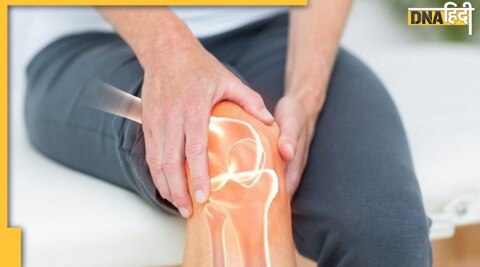 ayurvedic treatment relief in arthritis 