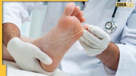 diabetic foot care tips 