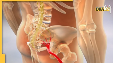 home remedies nerve pain