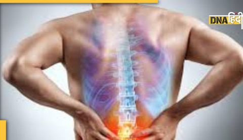 sciatica nerves pain causes and symptoms 