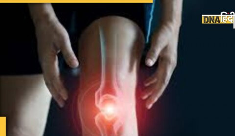 arthritis home remedies 