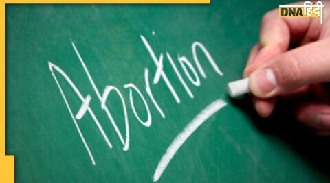 Abortion Law