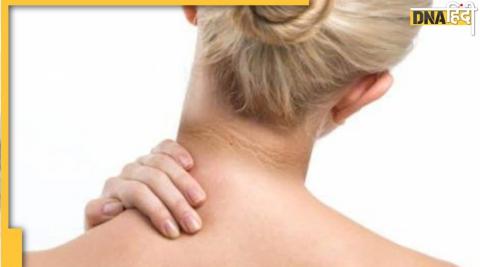 Dark Neck Remedies: काली गर्दन को 20 मिनट में करें साफ