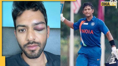 unmukt chand Eye injury