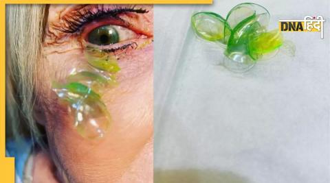 Contact lenses