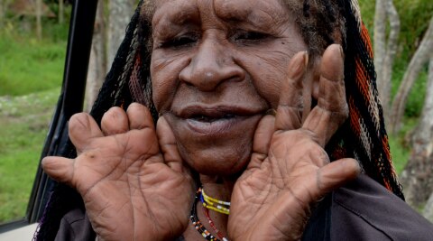   Women's fingers are cut in Dani tribe