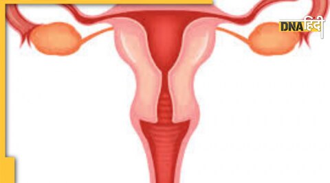 uterus problem causes and symptoms