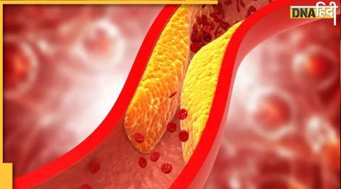 Cholesterol : नसाें में जम चुकी वसा और गंदगी को दूर कर देंगे ये फूड्स