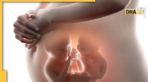 twin pregnancy causes symptoms judwa bache kaise pata kare 