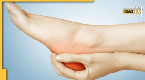 heel pain causes symptoms prevention 