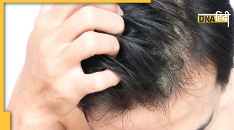 hair care tips hair itching problem remedies 