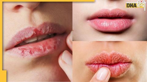 Chapped Lips Cure: नर्म-गुलाबी होंठ चाहिए तो घर में आसानी से बनाएं ये हर्बल लिप बाम