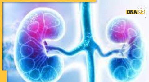 kidney donor health tips lalu yadav kidney transplant 