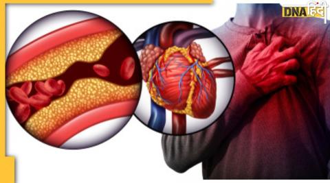 Blockage In Heart : हार्ट में ब्लॉकेज का संकेत है थकान के साथ ये 5 लक्षण, जरा सी देरी ले सकती है जान