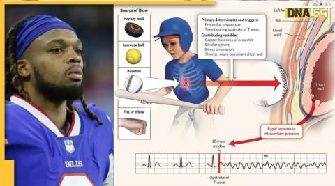 Footballer  Cardiac Arrest: फुटबॉलर डैमार हैमलिन को मैदान पर कार्डियर अरेस्ट