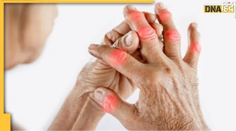 Arthritis: ठंड में इस वजह से बढ़ जाता है जोड़ों का दर्द, ऐसे पाएं छुटकारा