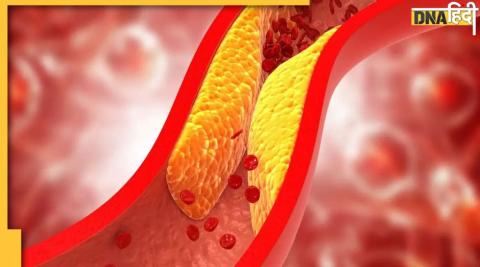 Reduce Cholesterol: नसों में जमी गंदगी और वसा को बाहर कर देते हैं ये मसाले