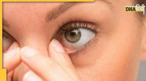 Diabetes Patient Eye Problems