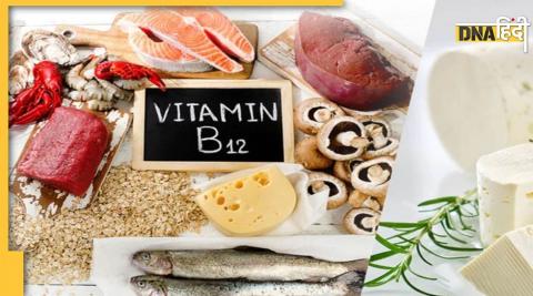 Vitamin B 12