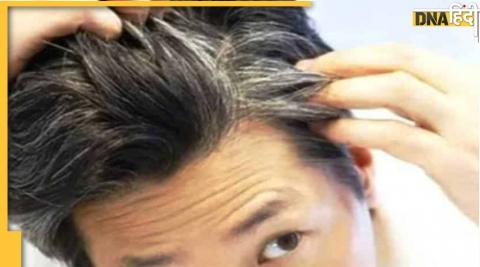 White Hair Remedies: सफेद बाल Black करने का ये है अचूक नुस्खा