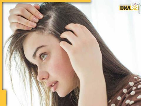 Hair Fall Remedies