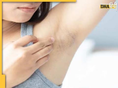 Underarms Whitening