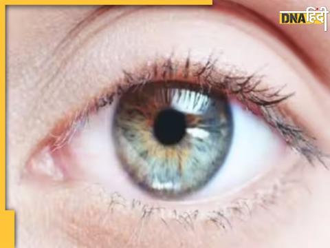 Eye Vision Loss