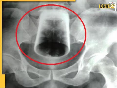 X-Ray