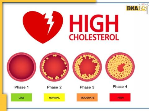 High Cholesterol Reducing Tips