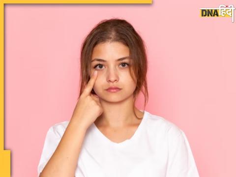 जिद्दी डार्क सर्कल हफ्ते भर में हो जाएंगे गायब, आजमाएं ये असरदार नुस्खा Dark Circles Removal