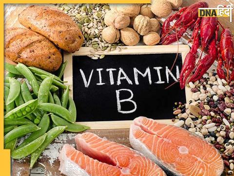 Vitamin B12 Foods