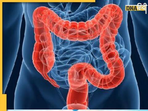 Signs and Symptoms of unhealthy gut