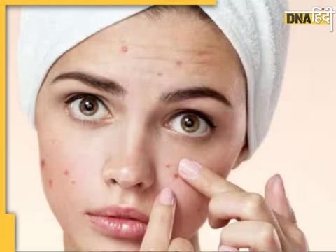 Skin Care Tips