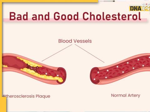 How to Increase HDL aka Good Cholesterol