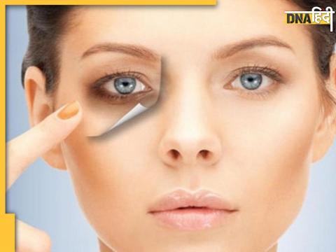 Dark Circles Removing Tips 