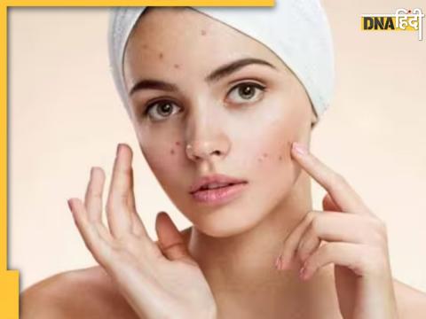 Skin Care Tips