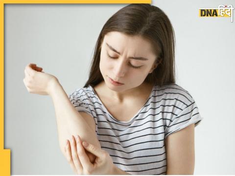 Home Remedy For Dark Elbow