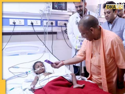 Yogi Adityanath घायल बच्ची से मिलने के लिए ट्रॉमा सेंटर पहुंचे.