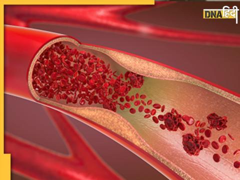 Blood clotting sign