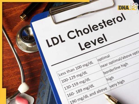 High Cholesterol Symptoms and signs