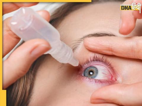 Best Home Remedy For Eye Flu