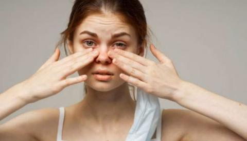 Home Remedies for Eye Irritation