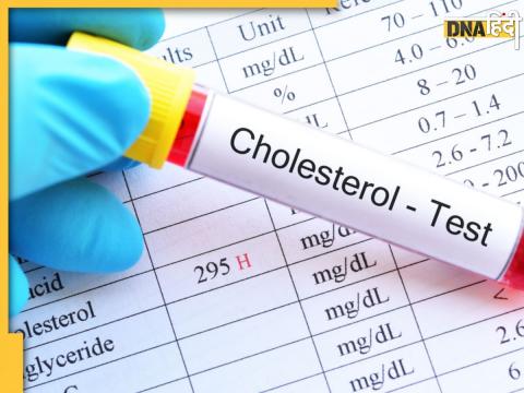 Cholesterol Test