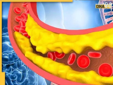 ब्लॉक नसों को खोलने का सबसे तेज तरीका