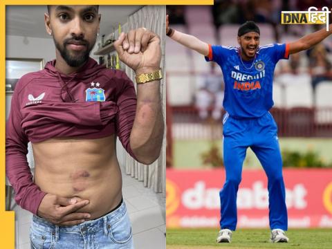 ind vs wi t20 series 2023 arshdeep singh hits nicholas pooran in stomach brandon kings hits his hand