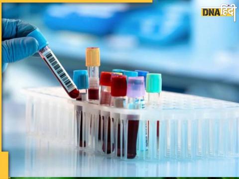 Rapid Blood Test For 18 Infection Diseases