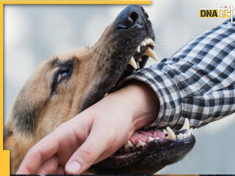 Rabies symptoms and Treatment