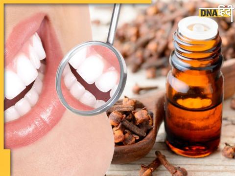 Clove Oil For Teeth Pain