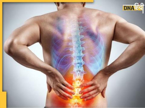 Lower Back Pain Causes